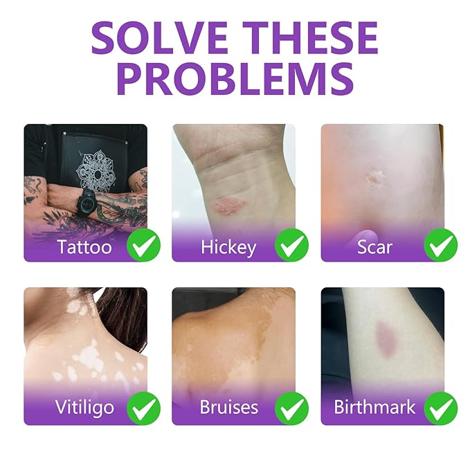 Tattoo Cover Up Makeup Waterproof, Sweatproof Tattoo Cover Up Concealer, Long-Lasting for Tattoos, Vitiligo, Spots, Scars, Invisible Skin Concealer, 2 Colors