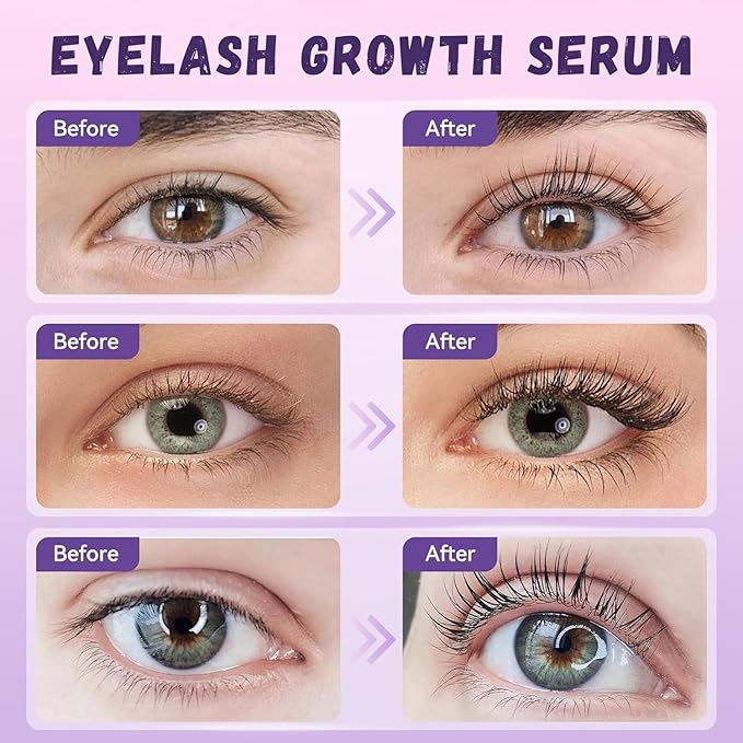 Lash Serum: Eyelash Growth Serum Gentle Natural Vegan Enhancing Treatment Nourishing Conditioning Formula for Longer Thicker Fuller Natural Lashes -5ml