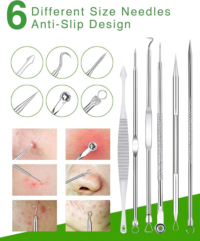 15 PCS Blackhead Remover Pimple Popper Tool Kit,Black Head Removal Extractor for Acne Comedone Whitehead Popping Zit Blemish Facial Skin Care Tools with Metal Case