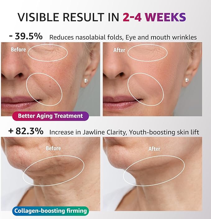 Red Light Therapy for Face and Neck, Renewal Face Lift Device with Vibration Tech, 3 in 1 Face Massager Tool with Thermals, True Beauty Glow Facial Sculptor for Wrinkles, Double Chin (White)