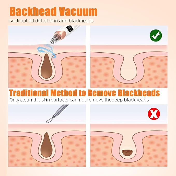 2025 Pore Vacuum, USB Rechargeable Blackhead Remover Vacuum,3 Levels Adjustable Pore Vacuum Blackhead Remover, with 5 Suction Power,6 Probes,Face Vacuum Pore Cleanser for Women & Men-White