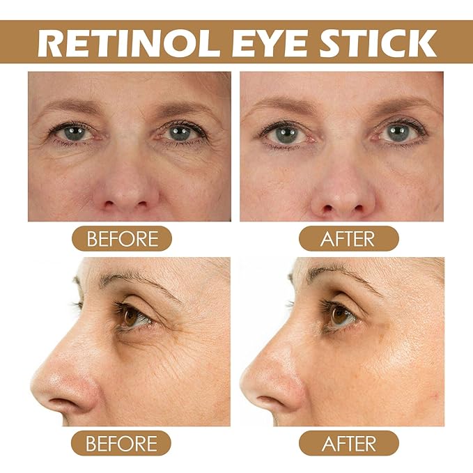 Retinol Eye Stick with Collagen & Hyaluronic Acid Eye Cream for Dark Circle and Puffiness, Brightening Eye Balm Reduces Fine Lines and Bags in 4 Weeks