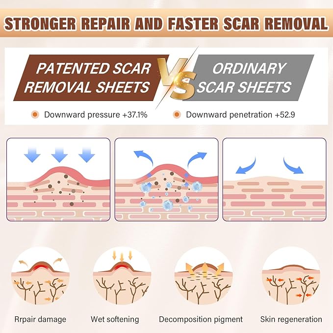 Silicone Scar Sheets,Silicone Scar Tape,Silicone Sheets