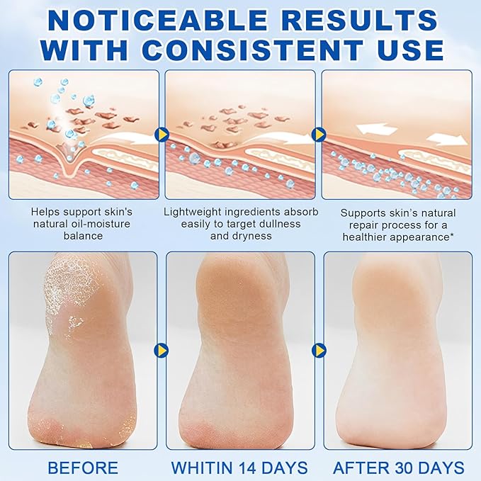 Urea Cream 60 Percent for Feet, 2% Salicylic Acid Urea Foot Cream for Cracked Heels and Dry Skin, Deep Moisturizing, Cracked Heel Repair Cream, Repairing Creams for Heels, Knees, Elbows & Hands (2)