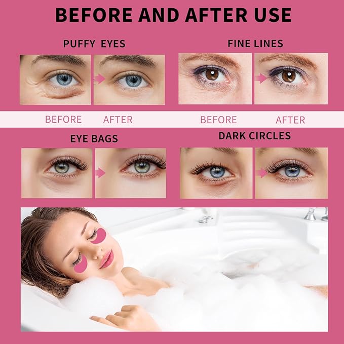 Under eye patches for puffy