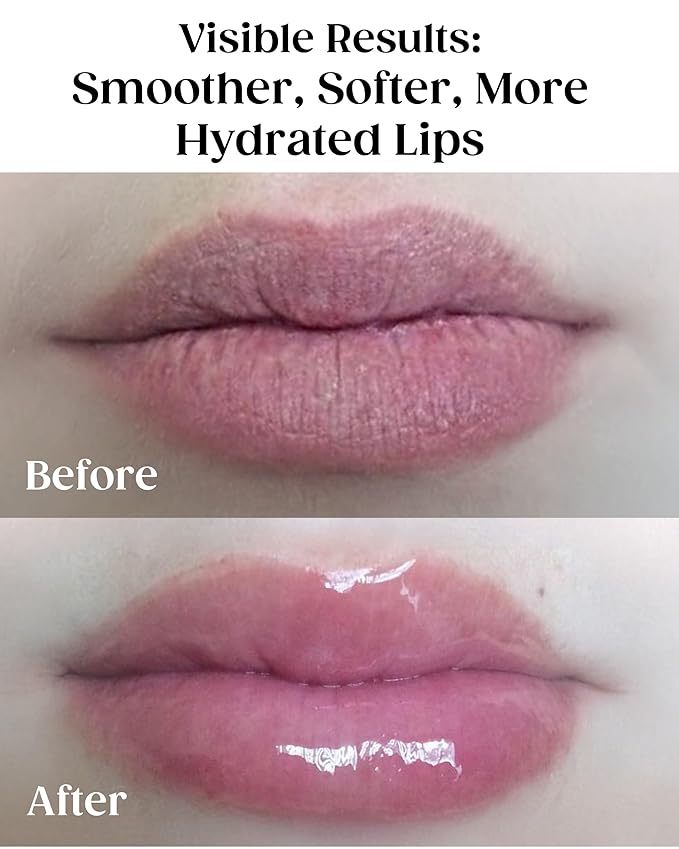 KAPLAN MD Perfect Pout Duo Lip Mask (0.5 oz.) & Lip Balm 0.17 oz. - Complete Anti-Aging Skin Care for Lips