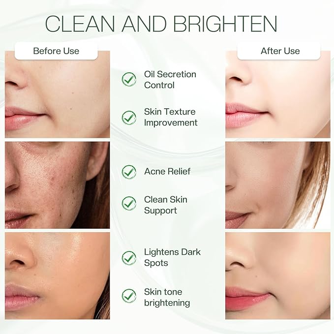 Glycolic Acid Pads 20%: Dual Sided Exfoliating Face Peels with Salicylic Acid & Niacinamide Reduce Surface Skin Fine Lines and Wrinkles Daily Facial Cleansing for All Skin Types 60 Count