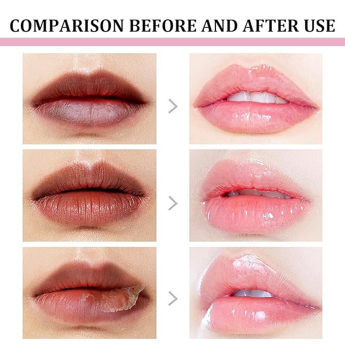 2pcs Lip Lightening for Dark Lips Lip Brightener for Smokers Dark Lip Treatment Lightening Cream for Pink Lips Lip Lightener for Smoker Lips Lip Lightening balm for Men and Women (Pink)
