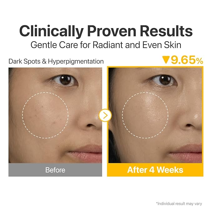 numbuzin No.5 Serum | Glutathione Vitamin Concentrated Serum 30ml Travel Set (+1ml*10ea) | Glutathione, Vitamin C, Tranexamic Acid | Hyperpigmentation, Acne Scars, Korean Skincare | 1.31 fl. oz.