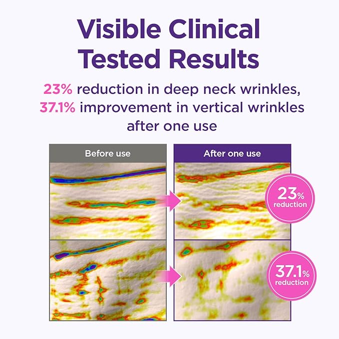 CKD Gua Sha Neck Cream Filltocshot [Refill] - Advanced Anti-Aging Neck Firming Cream with Massage Roller. Visibly Reduces Wrinkles, Lifts & Tightens Sagging Skin, Boosts Elasticity, Korean Skincare.