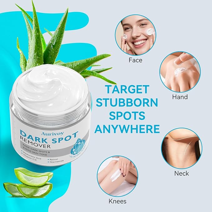 Dark Spot Remover for Face and Body – Dark Spot Corrector Serum for All Skin Types – Fades Age Spots, Sun Spots, Melasma – Anti-Aging Fade Cream for Uneven Skin Tone 1.7 Fl Oz