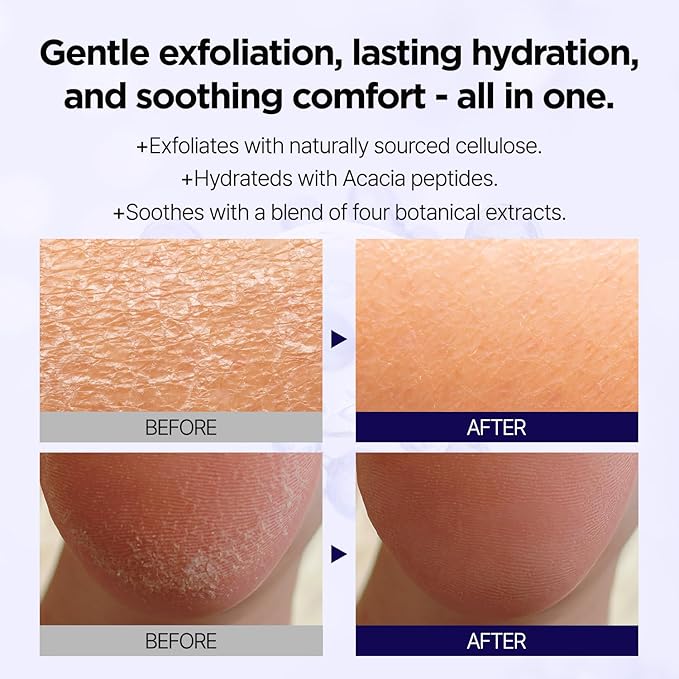 PONGDANG Exfoilation Duo for Face : Rice Wash-Off Mask with Honey & Deep Clean Soft Peeling Gel Set, Dead Skin Cells & Blackhead Care, Skin Tone Balance, Hydrating | Korean Skin Care