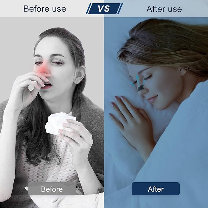100PCS Nasal Strips for Snoring, Nose Strips for Breathing, Snore Stopper, Nasal Congestion Relief, and Better Sleep Aid