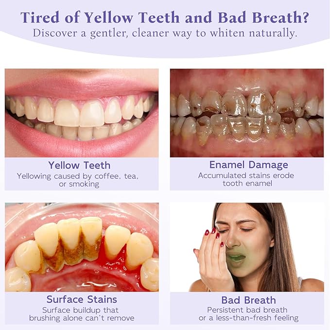 Teeth Whitening Powder,Remineralizing Hydroxyapatite Tooth Powder with Niacinamide,R5X Purple Color Corrector for Instant Brightening, Enamel Repair & Long-Lasting Natural White-30g