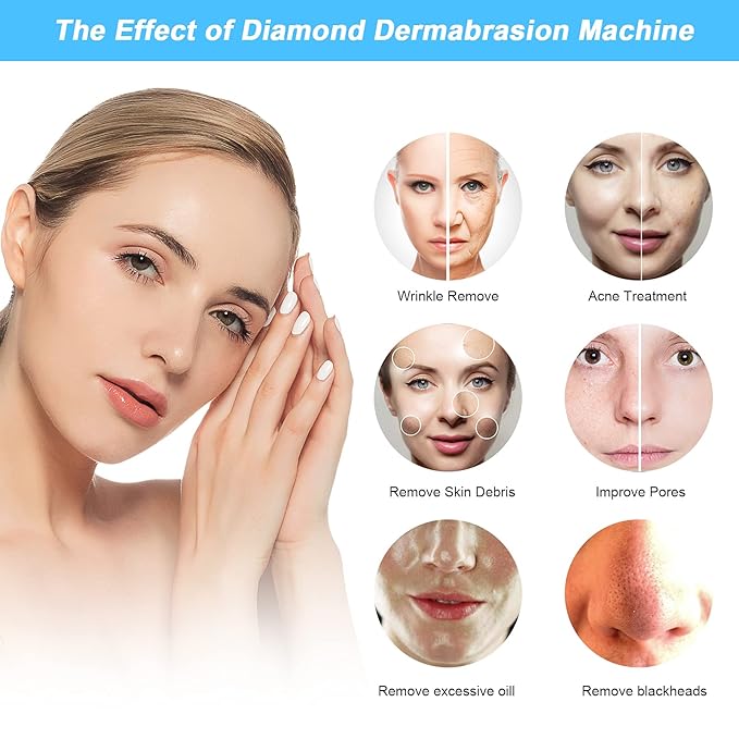 2 in 1 Diamond Microdermabrasion Machine Professional Blackhead Removal Equipment, 65-68cmHg Suction Power Professional Dermabrasion Facial Skin Care Massager for Home Salon Use with 300 Cotton Filter