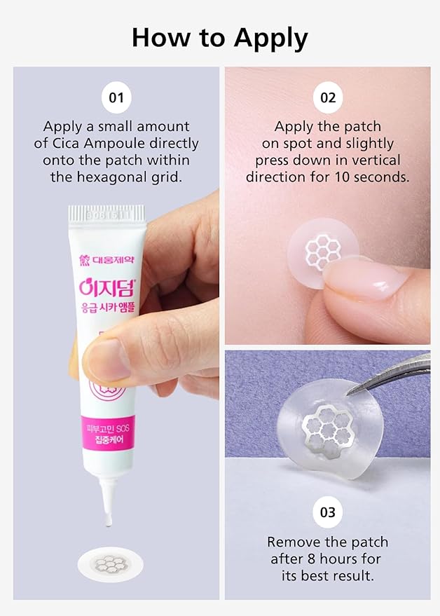 EasyDerm Quick Calming Magnesium Patches – 30 Patches Bulk Pack, Individually Wrapped Acne Care, Includes Tweezers & Ampoule, Korean Skincare, Made by Daewoong Pharmaceutical