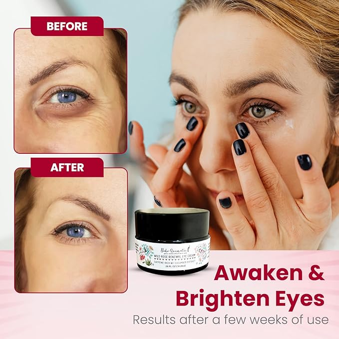 Wild Rose Renewal Eye Cream, Under Eye Cream, Natural Eye Cream for dark circles and fine lines, Green Beauty Product for under Eye area, Natural Skin Care .55 FL OZ (16.26ml)