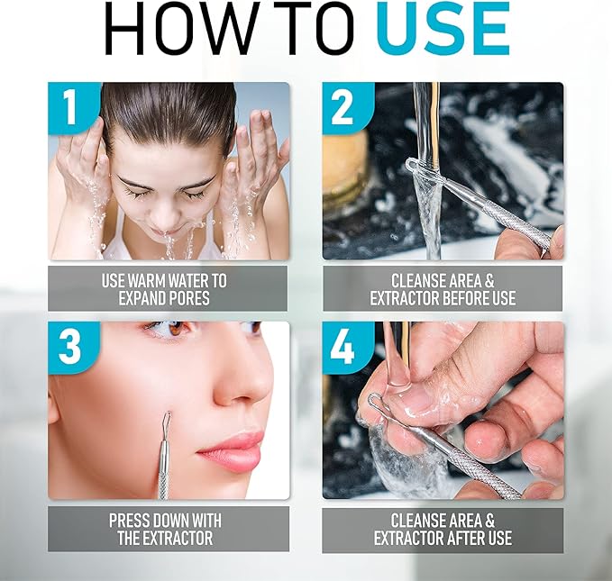 Hula Home Blackhead Remover Pimple Extractor Popper Tool Acne Comedone Blackhead, Blemish, Whitehead Popping, Zit Removing for Nose Face, 304 - Stainless Steel