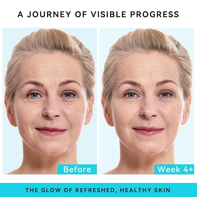 Retinol, Collagen & Hyaluronic Acid Face Cream - Anti-Aging Moisturizer for Face, Neck & Décolleté - Deep Nourishing, Firming & Wrinkle Reduction - Day & Night Use, 1.7 fl.oz.