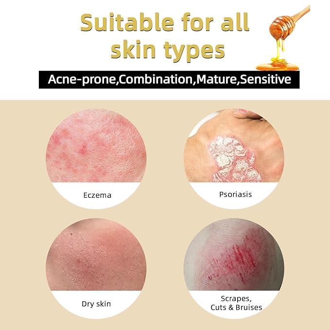 Beef Tallow for Face Skin, Tallow and Honey Balm for Skin Honey Butter Faces & Body Cream For Skins Firming & Hydrating Balm Care Tallows Face Moisturizer Cream, 2.12 Oz, 1PC