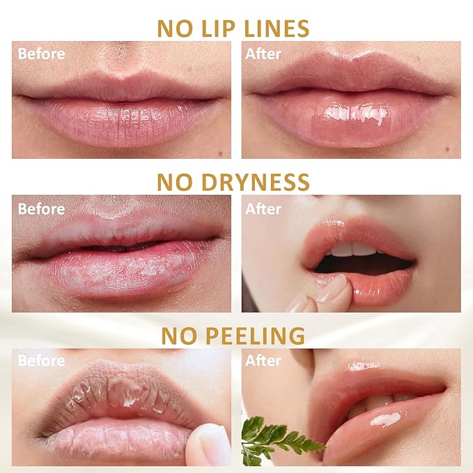 DMSKY 6 PCS Bee Lip Balm Honey Pot, Propolis Lip Mask Overnight, Moisturizing Hydrating Lip Sleeping Mask Prevention Dry and Cracked, Reduce Lip Lines