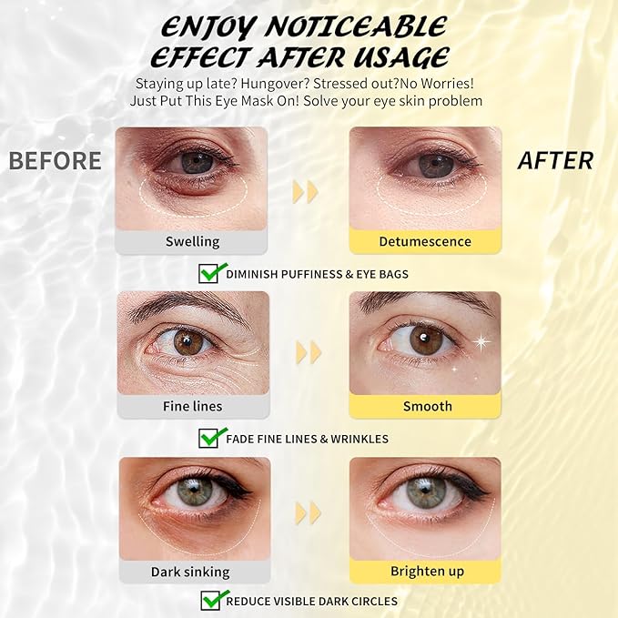 Under Eye Patches (50 Pairs), Hyaluronic Acid Eye Masks for Dark Circles Puffy Eyes Undereye Bags, Collagen Eye Patches for Wrinkles and Hydrate, Skin Care Gift for Her