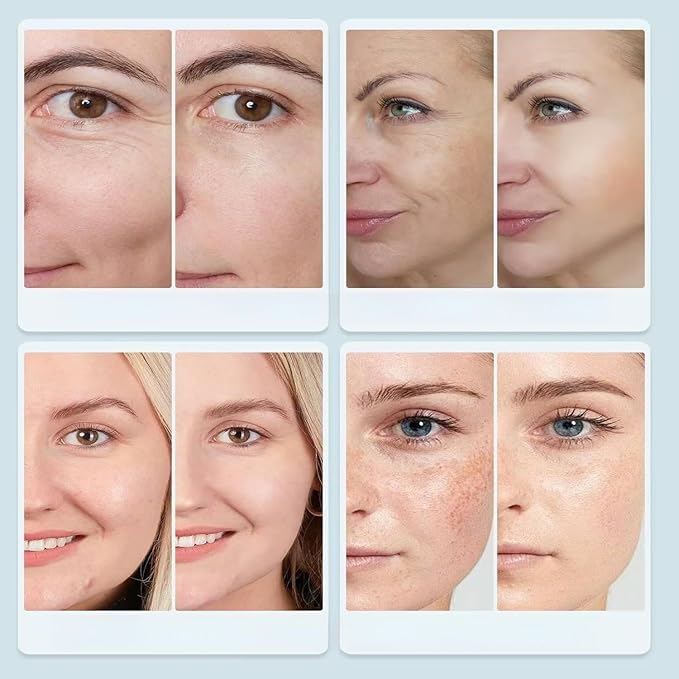 Multi-Color LED Glow Facial Mask - Rechargeable Beauty Lighting Device with Auto Timer (White)