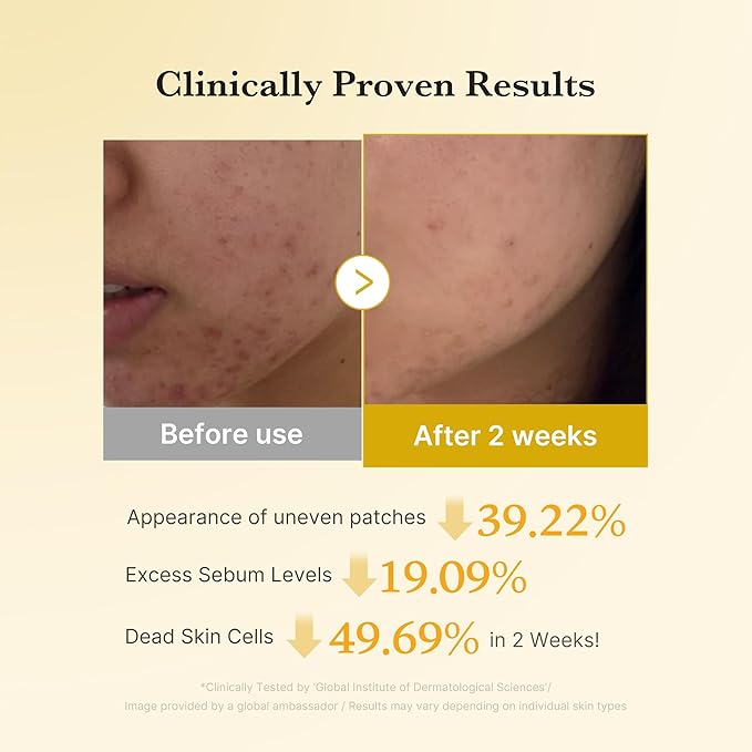 medicube Kojic Acid Turmeric Clarifying Toner Pad for Troubled Skin & Use After Spot Care, Soothing & Calming with Kojic Acid, Turmeric, Niacinamide & Glycolic Acid, Korean Skin Care, 70 Pads, 1 Pack