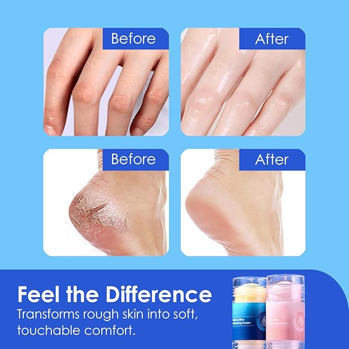 Crack Feet Prevention Stick(2Pcs) | Anti Crack Foot Cream Stick, Moisturizing Foot Balm Sticks, Heel Balm, Foot Glides, Softening and Nourishing Cream for Dry Heels