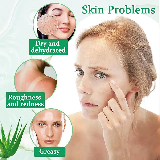 8PCS Aloe Vera Gel for Face & Skin,Organic Aloe Vera Gel,Hydrating After Sun Cream for Travel Size,Moisturizing Lotion for Skincare,After Sun Lotion for All Skin Type(C)