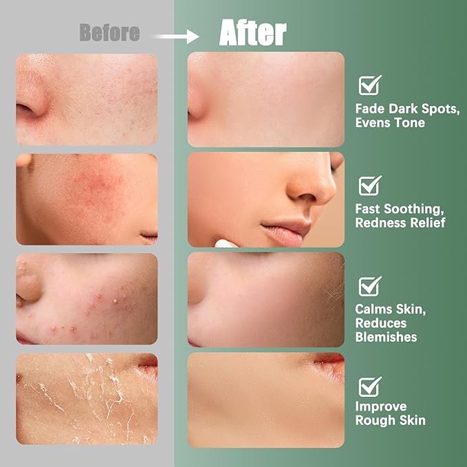 Madecassoside Toner Pads|Soothe Redness,Strengthen Barrier & Refine Pores with Centella Asiatica,Caffeine + Niacinamide | 110 Pads for All Skin Types