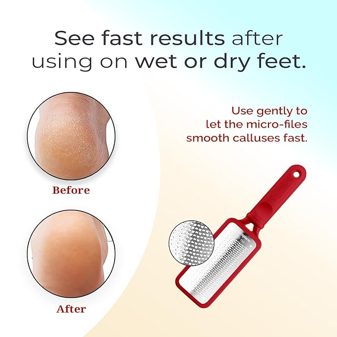Microplane Colossal Foot File Scraper - The Original Stainless Steel Foot Rasp, Dead Skin/Callus Remover for Feet, Gentle Foot Scrubber, Pedicure Tools for Salon-Quality Foot Care, Red