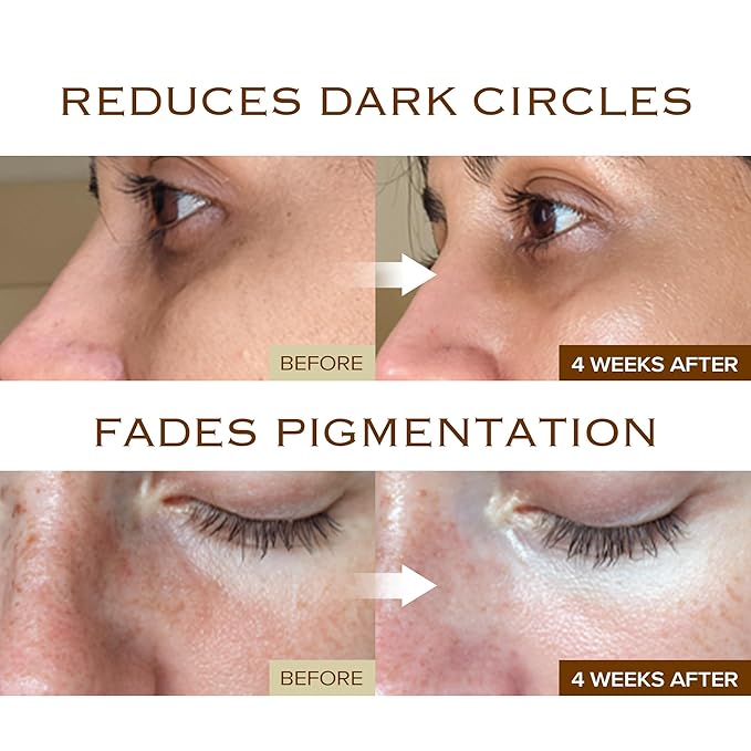 Dark Spot Ampoule | Korean Clinic Skincare - NAD+ 0.1% & Thioctic Acid 0.01% & Niacinamide 10% | Overnight Treatment for Melasma, Hyperpigmentation, Discoloration, Acne Scars | 15ml/0.33 Fl Oz