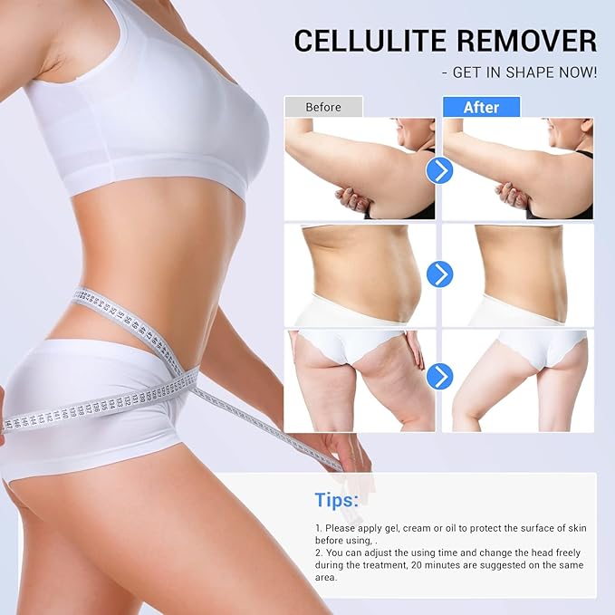 Improvement in The Appearance of Cellulite Device Cellulite Massager Radio Frequency, Home Use