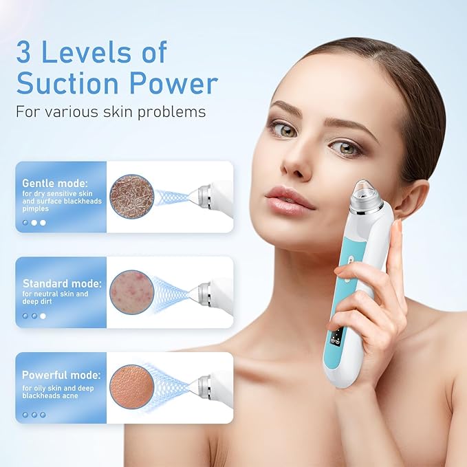 Facial Pore Blackhead Remover Vacuum, 1080P Camera Blackhead Remover, 20x Zoom, 8 LEDs ＆ 3 Suction Modes, 800mAh Battery & USB - 6 Heads Pore Cleaner Kit for Women&Men(Blue)
