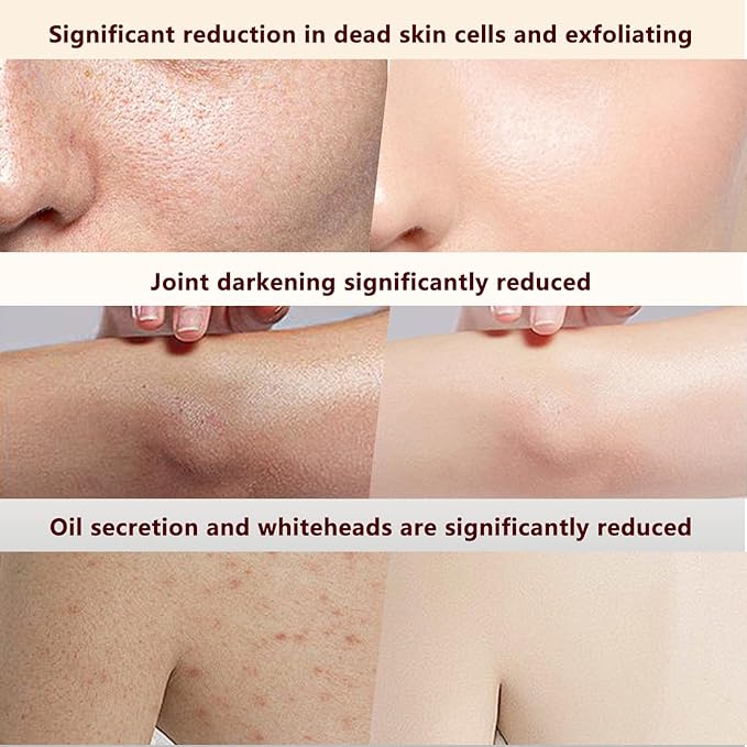 Rice Peel Shot, Peel Shot Glow Rice Ampoule Duo, Gently Exfoliates, Removes Dead Skin and Blackheads, Says Goodbye to Roughness and Dullness, and Makes Your Skin Glow 160 ML 2.7 Fl Oz (Pack of 2)