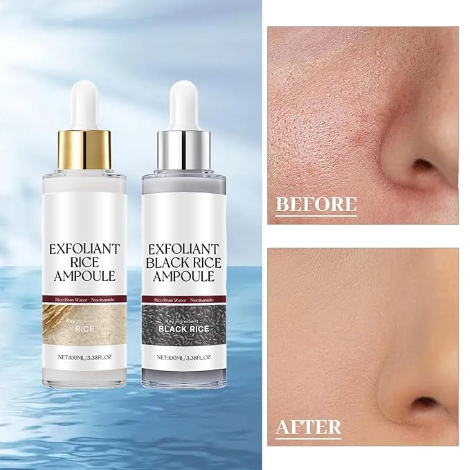 Black and White Rice Peeling, New Soft Rice Exfoliating Face and Body, Black and White Rice Exfoliant for All Skin Types, Gentle Peel & Deep Hydration (White+Black) 2P