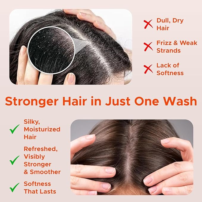 Nora Ross Garlic Extract Clarifying and Strengthening Shampoo and Conditioner with Rosemary – Deep Cleansing, Oil Control Combo for Women and Men – Vegan Formula with Fresh Chamomile – 32 oz each