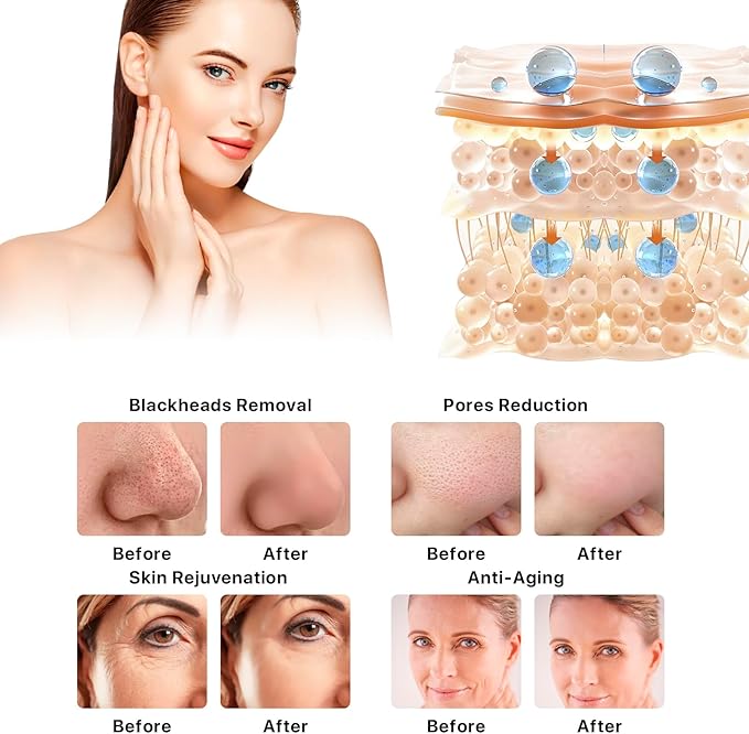 Hydrogen Oxygen Facial Beauty Skin Machine Improvement in The Appearance of Cellulite Device