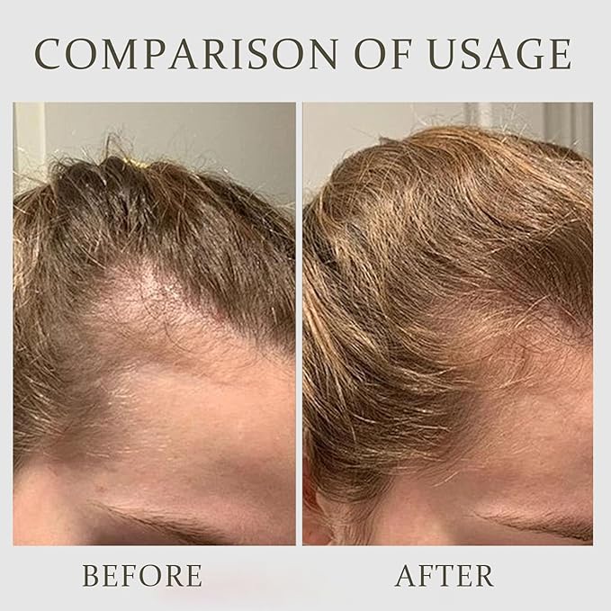 Le Jardin Switzerland Hair Serum, The Hair Multiplier, Nourishing Formula that Supports Fuller, Healthier-Looking Growth(2)