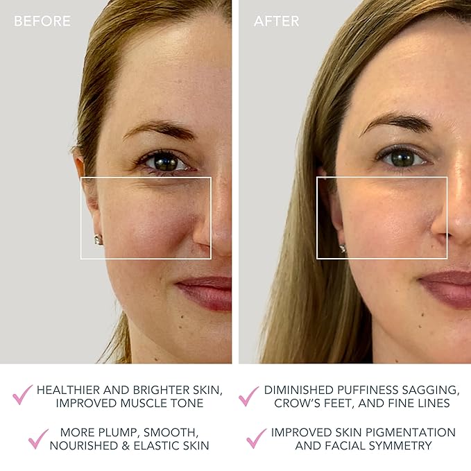 FOREO BEAR Mini Microcurrent Facial Device - Face Sculpting Tool - Firm & Contour - Reduce Double Chin - Non-Invasive - Increases Absorption of Facial Skin Care Products - Pearl Pink