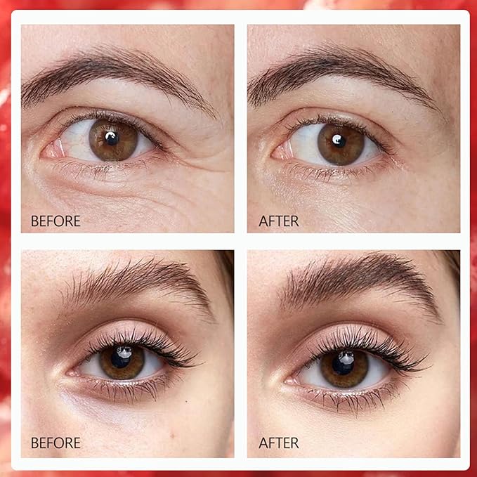 Pomegranate Eye Cream, Under Eye Cream For Dark Circles, Dark Circle Eye Cream For Puffiness And Bags, Anti Aging Eye Cream For Reduce Fine Lines & Wrinkles