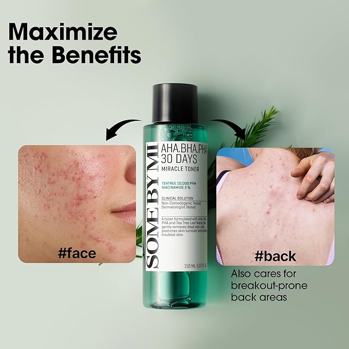 SOME BY MI AHA BHA PHA 30 Days Miracle Toner – 5.07oz, 150ml – Korean Salicylic Acid Exfoliating Face Toner for All Skin Types – Daily Pore Care & Oil Control with 2% Niacinamide – Korean Skin Care