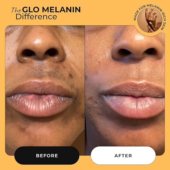 Glo Melanin All Natural Lemon and Turmeric Lip Balm - Natural Lip Balm Illuminate Your Smile, Brighten & Nourish Dark Lips Effortlessly - For Smokers Lips