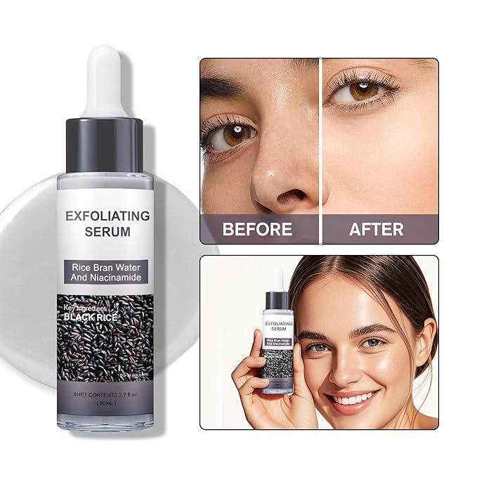 Peel Shot Glow Rice Ampoule Duo – Peel Shot Serums with White & Black Rice Extract, BHA, Niacinamide & Hyaluronic Acid – Exfoliating, Brightening, Moisturizing, Blackhead Remover & Pore Refining