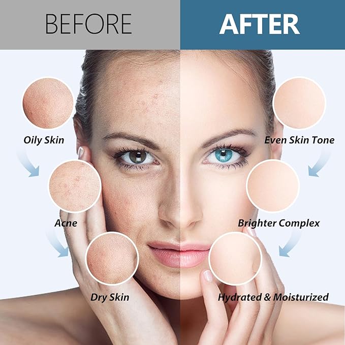 Jelly Mask for Facials Professional Hydrating Deep Cleaning Face Mask Set - 115Fl Oz 5 Treatments (Hyaluronic Acid,Bulgari Rose,24K Gold,VC Essence,Tea tree)