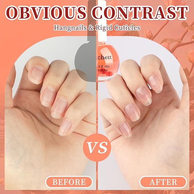 Meschett Cuticle Oil for Nails,Cuticle