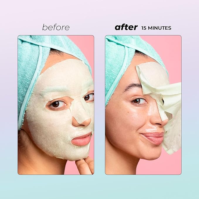 Vitamasques Probiotic Blackberry Face Sheet Mask 7 Pack - Korean Skin Care Facial Mask Rebalances & Repairs Skin with Multi Molecular Hyaluronic Acid - Natural & Biodegradable