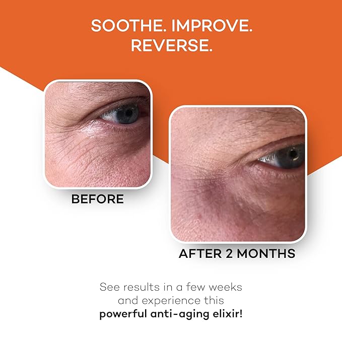 Zocufill Elixir Eye Gel and