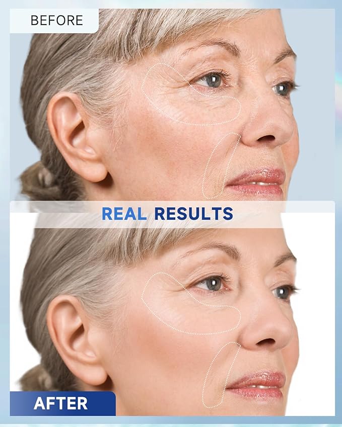 Retinol Cream for Face, Face Moisturizer with Collagen & Hyaluronic Acid, Anti Aging Neck Cream for Tightening Skin, Facial Creams Day & Night for Women and Men 2-Pack